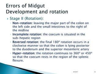 Normal Ob Gut Rotation Neonatal intestinal obstruction | PPTX