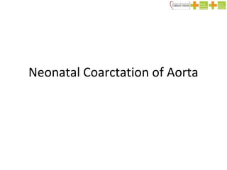 Neonatal Coarctation of Aorta
 
