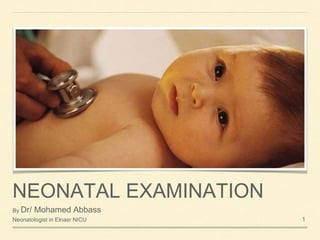 NEONATAL EXAMINATION
By Dr/ Mohamed Abbass
Neonatologist in Elnasr NICU 1
 