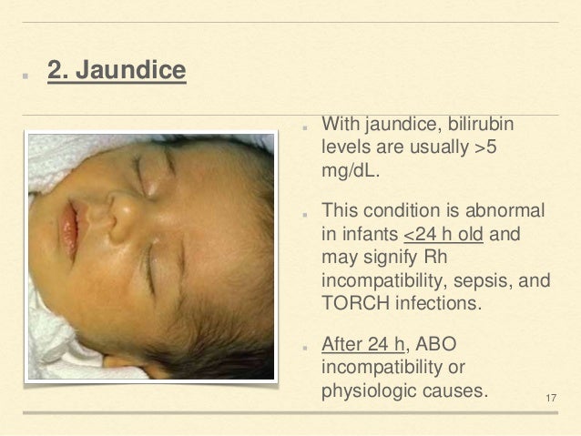 Neonatal 20 examination Neonatal 20 examination