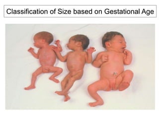 Classification of Size based on Gestational Age
• SGA - Small for
gestational age-weight
below 10th percentile
• AGA - Weight between 10
and 90th percentiles
• LGA - Weight above
90th percentile
 