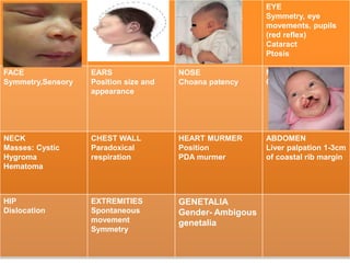 SKIN
Neurocutaneous
lesions
Milia
Mangolian spots
HEAD
Microcephaly,
SUTURE
(sagittal, coronal,
lambdoid, and
metopic)
Molding
EYE
Symmetry, eye
movements, pupils
(red reflex)
Cataract
Ptosis
FACE
Symmetry,Sensory
EARS
Position size and
appearance
NOSE
Choana patency
MOUTH
Cleft palate
NECK
Masses: Cystic
Hygroma
Hematoma
CHEST WALL
Paradoxical
respiration
HEART MURMER
Position
PDA murmer
ABDOMEN
Liver palpation 1-3cm
of coastal rib margin
HIP
Dislocation
EXTREMITIES
Spontaneous
movement
Symmetry
GENETALIA
Gender- Ambigous
genetalia
 