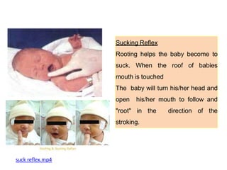 Sucking Reflex
Rooting helps the baby become to
suck. When the roof of babies
mouth is touched
The baby will turn his/her head and
open his/her mouth to follow and
"root" in the direction of the
stroking.
suck reflex.mp4
 