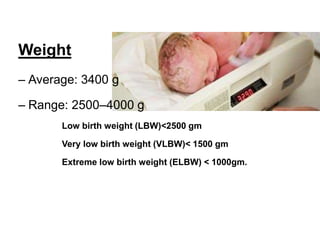 Weight
– Average: 3400 g
– Range: 2500–4000 g
Low birth weight (LBW)˂2500 gm
Very low birth weight (VLBW)˂ 1500 gm
Extreme low birth weight (ELBW) < 1000gm.
 