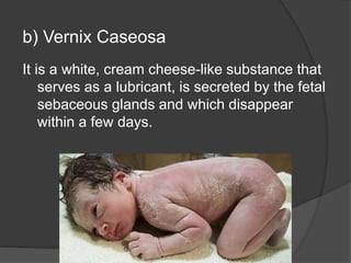 b) Vernix Caseosa
It is a white, cream cheese-like substance that
serves as a lubricant, is secreted by the fetal
sebaceous glands and which disappear
within a few days.
 