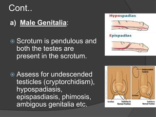 Cont..
a) Male Genitalia:
 Scrotum is pendulous and
both the testes are
present in the scrotum.
 Assess for undescended
testicles (cryptorchidism),
hypospadiasis,
epispasdiasis, phimosis,
ambigous genitalia etc.
 