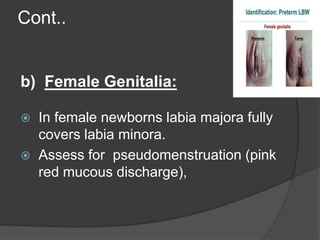 Cont..
b) Female Genitalia:
 In female newborns labia majora fully
covers labia minora.
 Assess for pseudomenstruation (pink
red mucous discharge),
 