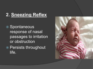 2. Sneezing Reflex
 Spontaneous
response of nasal
passages to irritation
or obstruction
 Persists throughout
life.
 