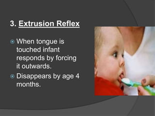 3. Extrusion Reflex
 When tongue is
touched infant
responds by forcing
it outwards.
 Disappears by age 4
months.
 