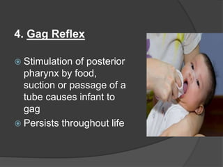 4. Gag Reflex
 Stimulation of posterior
pharynx by food,
suction or passage of a
tube causes infant to
gag
 Persists throughout life
 