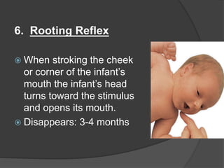 6. Rooting Reflex
 When stroking the cheek
or corner of the infant’s
mouth the infant’s head
turns toward the stimulus
and opens its mouth.
 Disappears: 3-4 months
 