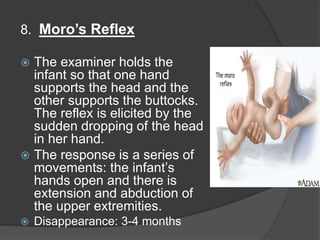 8. Moro’s Reflex
 The examiner holds the
infant so that one hand
supports the head and the
other supports the buttocks.
The reflex is elicited by the
sudden dropping of the head
in her hand.
 The response is a series of
movements: the infant’s
hands open and there is
extension and abduction of
the upper extremities.
 Disappearance: 3-4 months
 