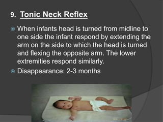 9. Tonic Neck Reflex
 When infants head is turned from midline to
one side the infant respond by extending the
arm on the side to which the head is turned
and flexing the opposite arm. The lower
extremities respond similarly.
 Disappearance: 2-3 months
 