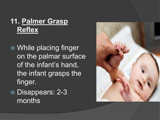 11. Palmer Grasp
Reflex
 While placing finger
on the palmar surface
of the infant’s hand,
the infant grasps the
finger.
 Disappears: 2-3
months
 