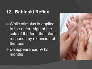 12. Babinski Reflex
 While stimulus is applied
to the outer edge of the
sole of the foot, the infant
responds by extension of
the toes
 Disappearance: 9-12
months
 