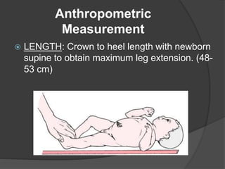Anthropometric
Measurement
 LENGTH: Crown to heel length with newborn
supine to obtain maximum leg extension. (48-
53 cm)
 