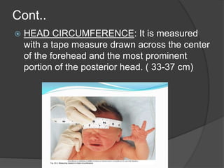 Cont..
 HEAD CIRCUMFERENCE: It is measured
with a tape measure drawn across the center
of the forehead and the most prominent
portion of the posterior head. ( 33-37 cm)
 