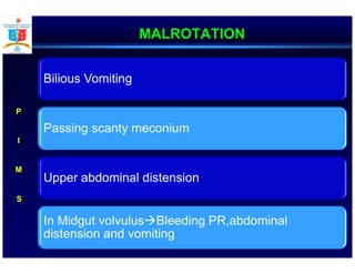 MALROTATION
Bilious Vomiting
Passing scanty meconium
Upper abdominal distension
In Midgut volvulus Bleeding PR,abdominal
distension and vomiting
P
I
M
 