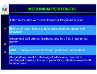 MECONIUM PERITONITIS
Often associated with cystic fibrosis & Prognosis is poor
Bilious vomiting, failure to pass meconium and abdominal
distension
Abdominal wall edema, erythema and free fluid in peritoneal
cavity
AXR multiple air fluid levels and peritoneal calcifications
Surgical treatment releasing of adhesions, removal of
devitalised tissues, closure of perforation, intestinal resection&
anastomosis
P
I
M
S
 