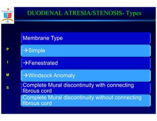 DUODENAL ATRESIA/STENOSIS- Types
Membrane Type
Simple
Fenestrated
Windsock Anomaly
Complete Mural discontinuity with connecting
fibrous cord
Complete Mural discontinuity without connecting
fibrous cord
P
I
M
S
 