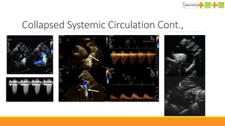 Neonatal cardiac emergency | PPTX