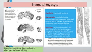 Neonatal myocyte 
Rounded, relatively short and quite 
disorganized intracellulary 
Myofibrils- contractile proteins 
Mature cells- myofibrils densily 
concentrated and are aligned in parallel 
with the axis of the cell, organized into 
alternating rows of mitochondria 
Neonates- myofibrils less dense and 
more likely to be situated along the 
periphery of the cell . The more central 
portion is made up of disorganized 
clumps of mitochondria and nuclei 
 
