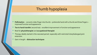 Thumb hypoplasia 
• Pollicisation - converts index finger into thumb – prehensile hand with a thumb and three fingers – 
improved function and appearance 
• Toe to hand transfer( second toe) – excellent improvement in function and appearance 
• Role for physiotherapist and occupational therapist 
• Therapy ideally started in the neonatal period- especially with restricted interphalangeal joint 
extension 
• Gain in length – distraction techniques 
 