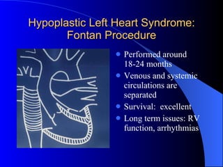 Hypoplastic Left Heart Syndrome: Fontan Procedure Performed around 18-24 months Venous and systemic circulations are separated Survival:  excellent Long term issues: RV function, arrhythmias 