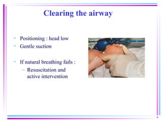 Clearing the airway

• Positioning : head low
• Gentle suction

• If natural breathing fails :
   – Resuscitation and
      active intervention
 
