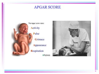 APGAR SCORE




Activity

  Pulse

   Grimace

  Appearance

Respiration
 