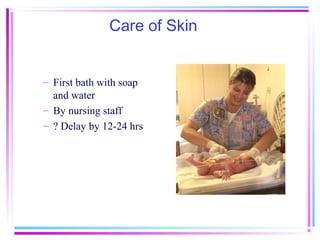Care of Skin


– First bath with soap
  and water
– By nursing staff
– ? Delay by 12-24 hrs
 