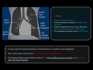 Imaging
• Mild increased lung volume.
• Interstitial edema resulting in perihilar linear
densities.
• Subtle enlargement of the cardiac silhouette.
• Pleural effusions and fluid in the fissures.
• The radiological findings may be asymmetrical.
 In many cases the clinical presentation is mild and there is no need for a chest radiograph.
 Only in some cases a chest x-ray is performed to rule out complications.
 The imaging findings may be similar to those of RDS, showing diffuse granular opacities, or of pneumonia
with more coarse opacities.
 