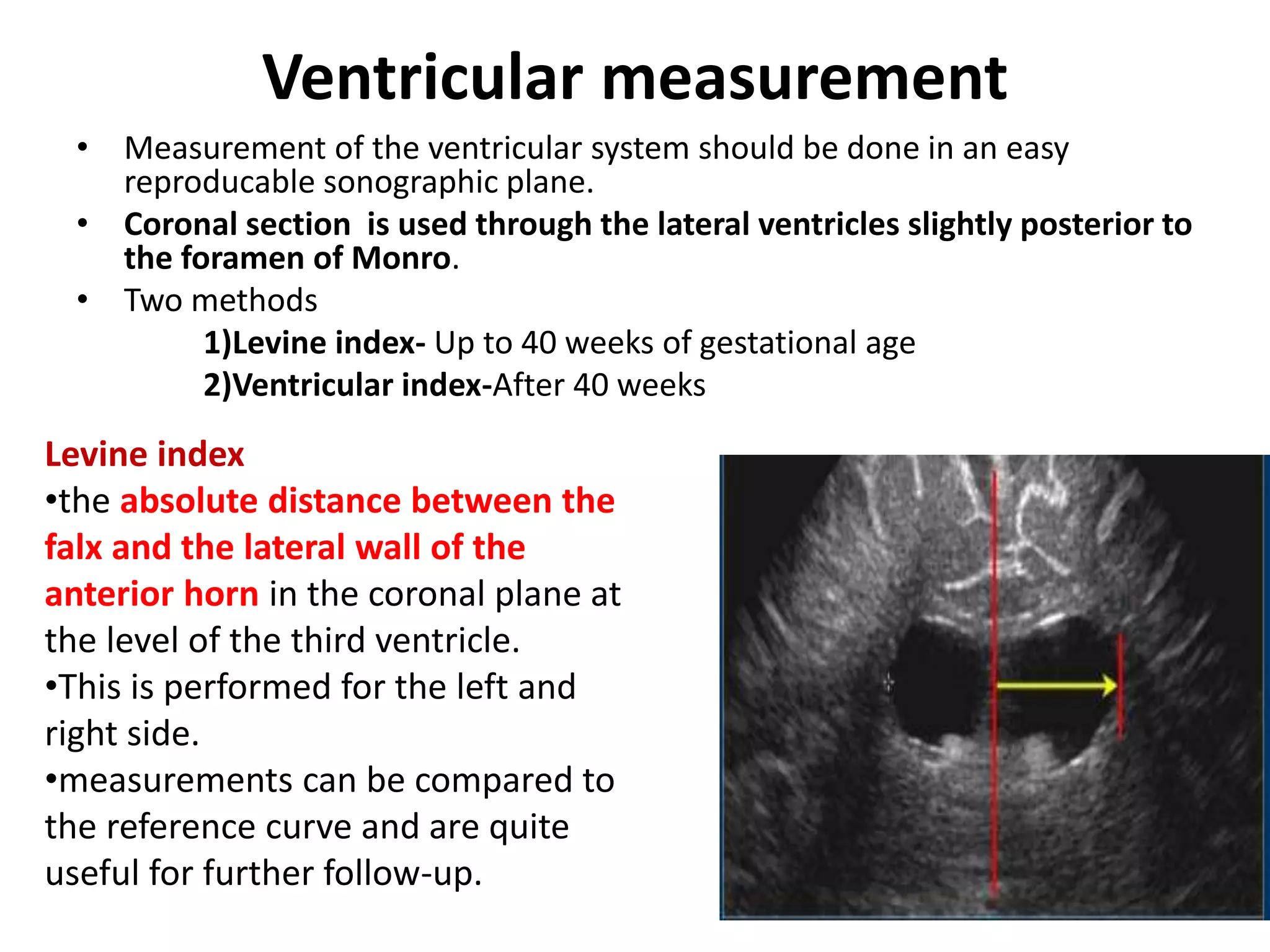 Ventricular measurement
• Measurement of the ventricular system should be done in an easy
reproducable sonographic plane.
• Coronal section is used through the lateral ventricles slightly posterior to
the foramen of Monro.
• Two methods
1)Levine index- Up to 40 weeks of gestational age
2)Ventricular index-After 40 weeks
Levine index
•the absolute distance between the
falx and the lateral wall of the
anterior horn in the coronal plane at
the level of the third ventricle.
•This is performed for the left and
right side.
•measurements can be compared to
the reference curve and are quite
useful for further follow-up.
 