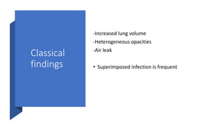 Classical
findings
-Increased lung volume
-Heterogeneous opacities
-Air leak
• Superimposed infection is frequent
 