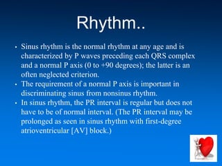 Rhythm..
• Sinus rhythm is the normal rhythm at any age and is
characterized by P waves preceding each QRS complex
and a normal P axis (0 to +90 degrees); the latter is an
often neglected criterion.
• The requirement of a normal P axis is important in
discriminating sinus from nonsinus rhythm.
• In sinus rhythm, the PR interval is regular but does not
have to be of normal interval. (The PR interval may be
prolonged as seen in sinus rhythm with first-degree
atrioventricular [AV] block.)
 
