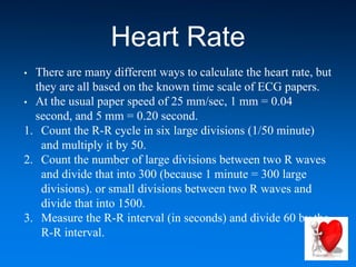 Heart Rate
• There are many different ways to calculate the heart rate, but
they are all based on the known time scale of ECG papers.
• At the usual paper speed of 25 mm/sec, 1 mm = 0.04
second, and 5 mm = 0.20 second.
1. Count the R-R cycle in six large divisions (1/50 minute)
and multiply it by 50.
2. Count the number of large divisions between two R waves
and divide that into 300 (because 1 minute = 300 large
divisions). or small divisions between two R waves and
divide that into 1500.
3. Measure the R-R interval (in seconds) and divide 60 by the
R-R interval.
 