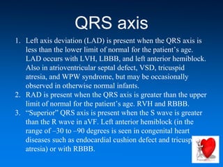 QRS axis
1. Left axis deviation (LAD) is present when the QRS axis is
less than the lower limit of normal for the patient’s age.
LAD occurs with LVH, LBBB, and left anterior hemiblock.
Also in atrioventricular septal defect, VSD, tricuspid
atresia, and WPW syndrome, but may be occasionally
observed in otherwise normal infants.
2. RAD is present when the QRS axis is greater than the upper
limit of normal for the patient’s age. RVH and RBBB.
3. “Superior” QRS axis is present when the S wave is greater
than the R wave in aVF. Left anterior hemiblock (in the
range of –30 to –90 degrees is seen in congenital heart
diseases such as endocardial cushion defect and tricuspid
atresia) or with RBBB.
 