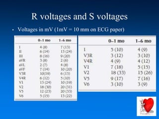 R voltages and S voltages
• Voltages in mV (1mV = 10 mm on ECG paper)
 