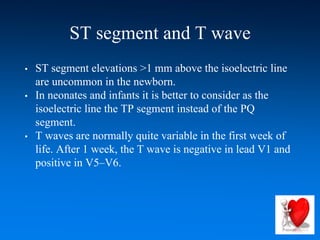 ST segment and T wave
• ST segment elevations >1 mm above the isoelectric line
are uncommon in the newborn.
• In neonates and infants it is better to consider as the
isoelectric line the TP segment instead of the PQ
segment.
• T waves are normally quite variable in the first week of
life. After 1 week, the T wave is negative in lead V1 and
positive in V5–V6.
 