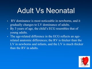 Adult Vs Neonatal
• RV dominance is most noticeable in newborns, and it
gradually changes to LV dominance of adults.
• By 3 years of age, the child’s ECG resembles that of
young adults.
• The age-related difference in the ECG reflects an age-
related anatomic differences; the RV is thicker than the
LV in newborns and infants, and the LV is much thicker
than the RV in adults.
 