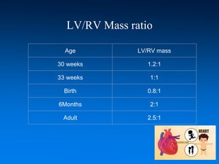 LV/RV Mass ratio
Age LV/RV mass
30 weeks 1.2:1
33 weeks 1:1
Birth 0.8:1
6Months 2:1
Adult 2.5:1
 