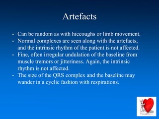 Artefacts
• Can be random as with hiccoughs or limb movement.
• Normal complexes are seen along with the artefacts,
and the intrinsic rhythm of the patient is not affected.
• Fine, often irregular undulation of the baseline from
muscle tremors or jitteriness. Again, the intrinsic
rhythm is not affected.
• The size of the QRS complex and the baseline may
wander in a cyclic fashion with respirations.
 