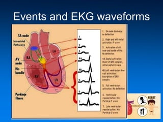 Events and EKG waveforms
 
