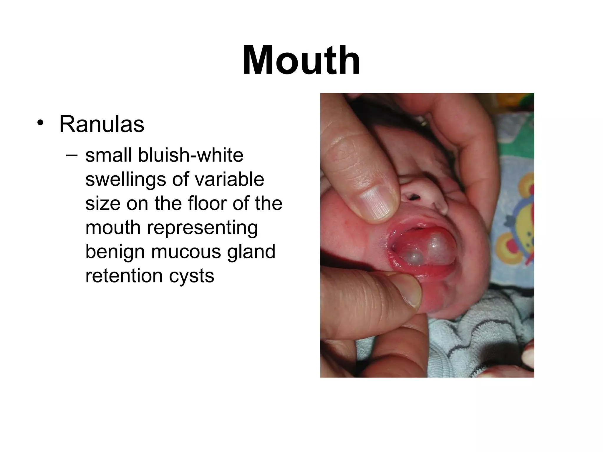 Neonatal examination | PPT