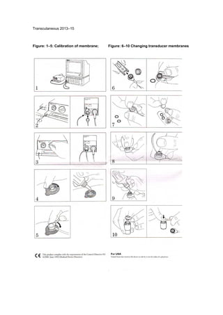 Neonatal guidelines NHS 2011 2013 Slide 361