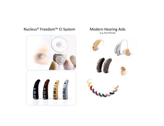 Nucleus® Freedom CI System   Modern Hearing Aids
                                  (e.g. from Phonak)
 