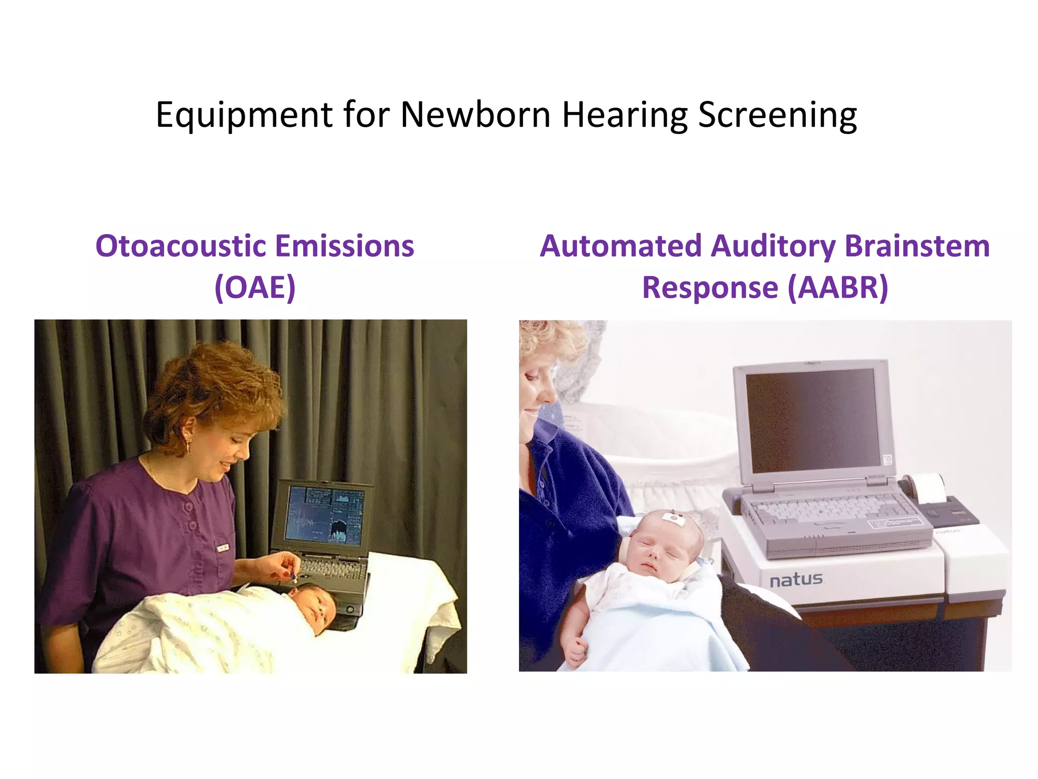 Equipment for Newborn Hearing Screening


Otoacoustic Emissions   Automated Auditory Brainstem
       (OAE)                 Response (AABR)
 