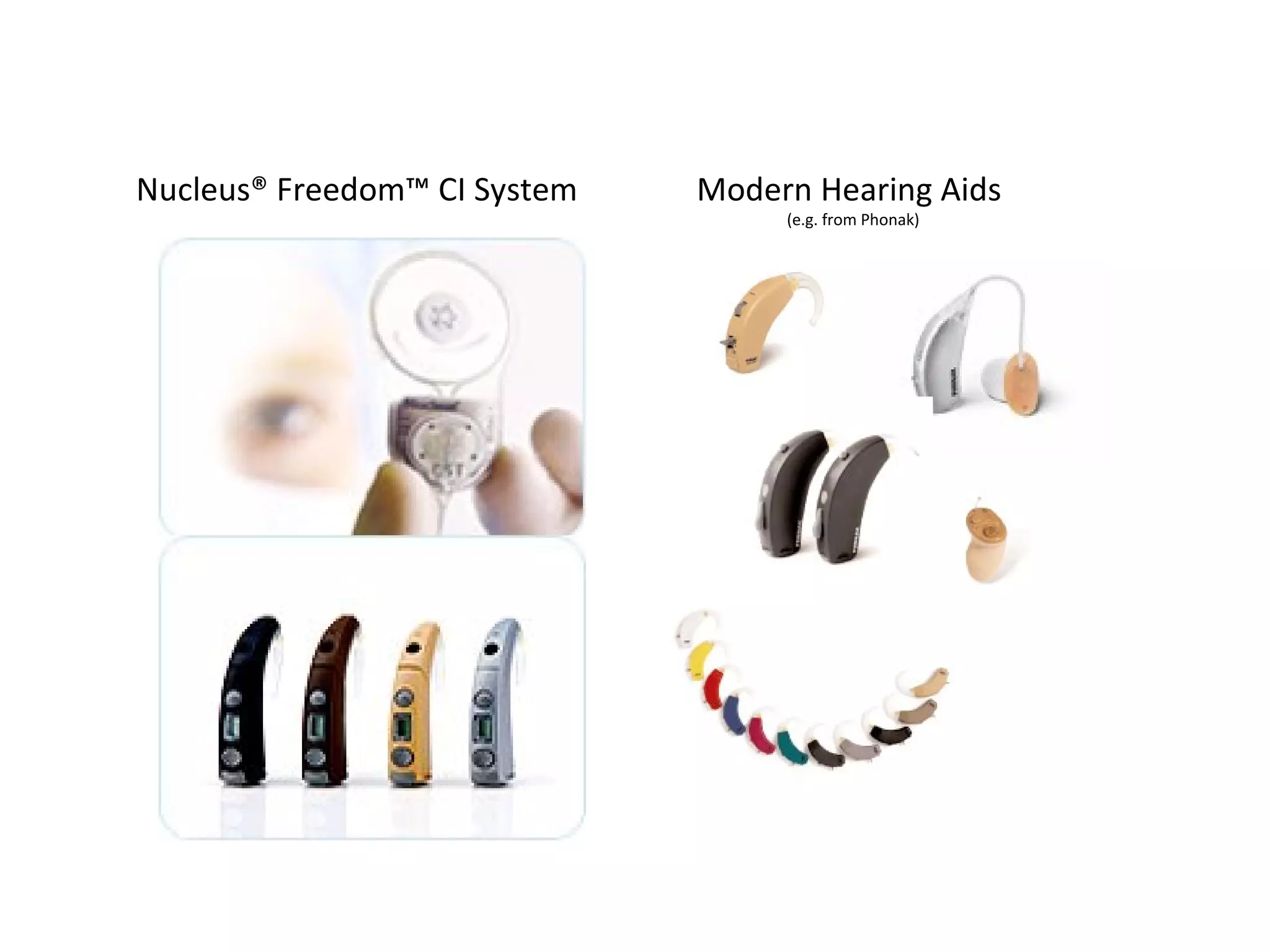 Nucleus® Freedom™ CI System   Modern Hearing Aids
                                   (e.g. from Phonak)
 