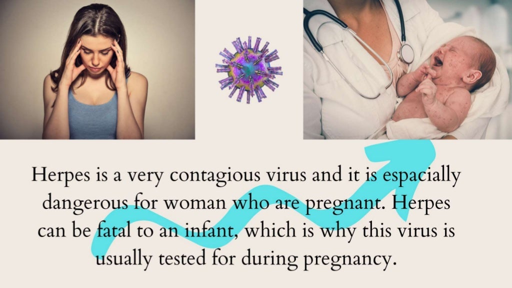 Neonatal Herpes Simplex Virus Herpes infection by baby Herpes