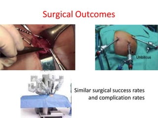 Surgical Outcomes
Similar surgical success rates
and complication rates
 
